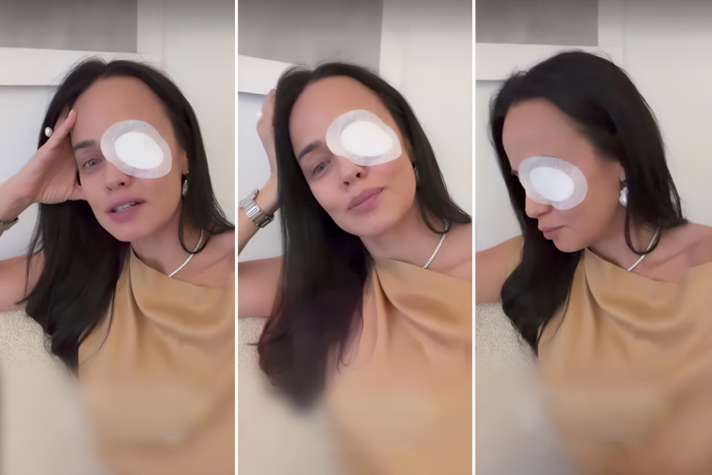 Andreea Raicu cu ochiul bandajat după un accident neașteptat. Câinele i-a zgâriat corneea: „E al naibii de dureros”